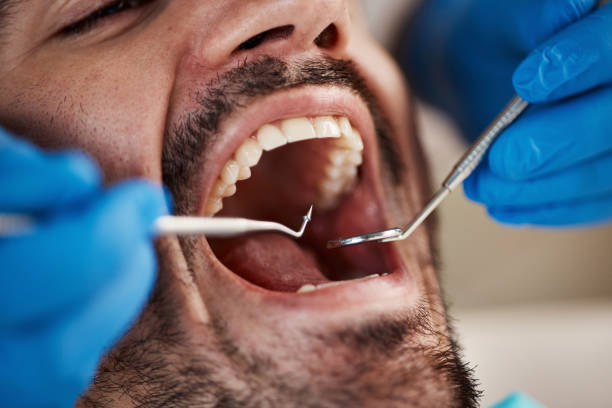 Emergency Dental Services in Elizabethville, PA
